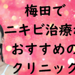 梅田のニキビの画像