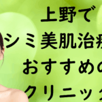 上野の美白の画像