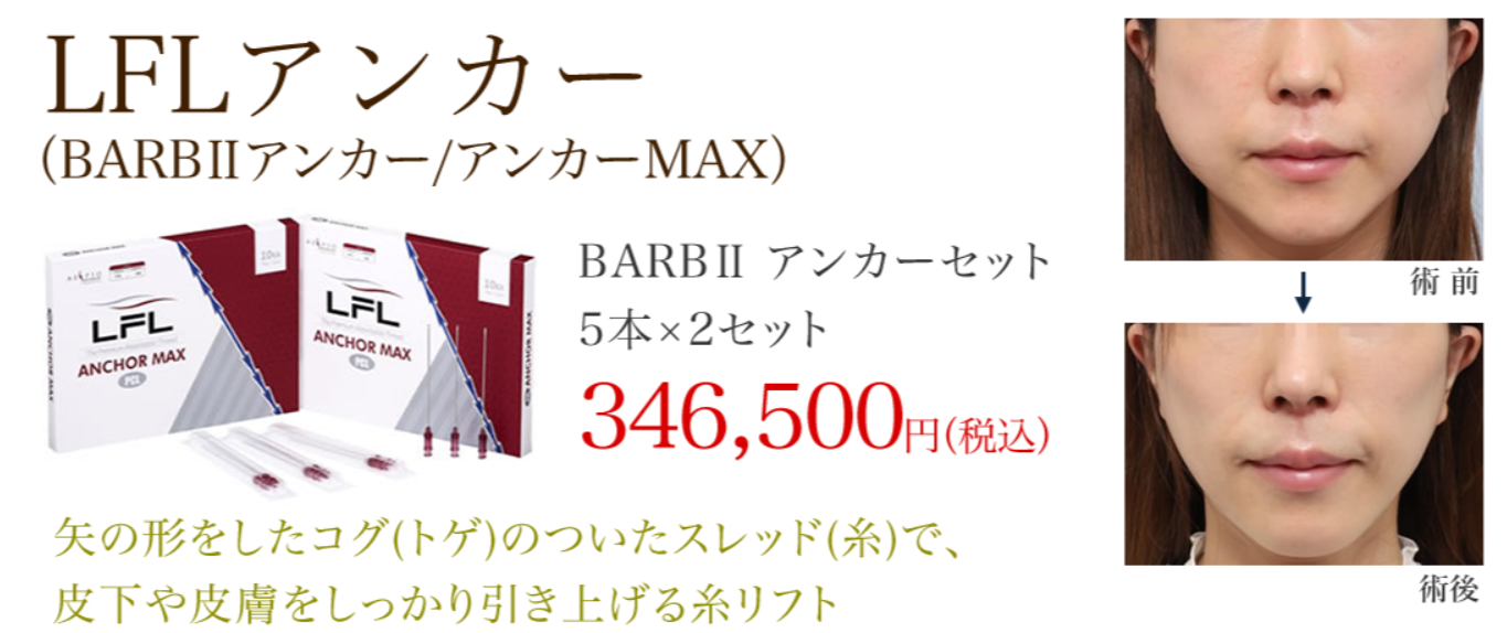 よだ形成外科クリニックの小顔の画像