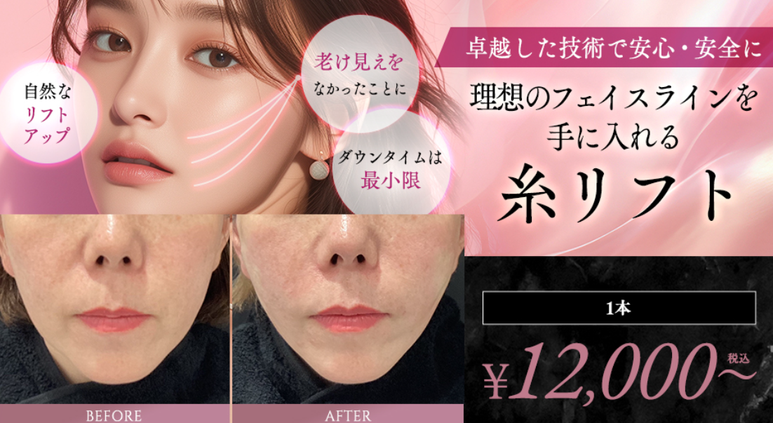 上野美容外科の小顔の画像