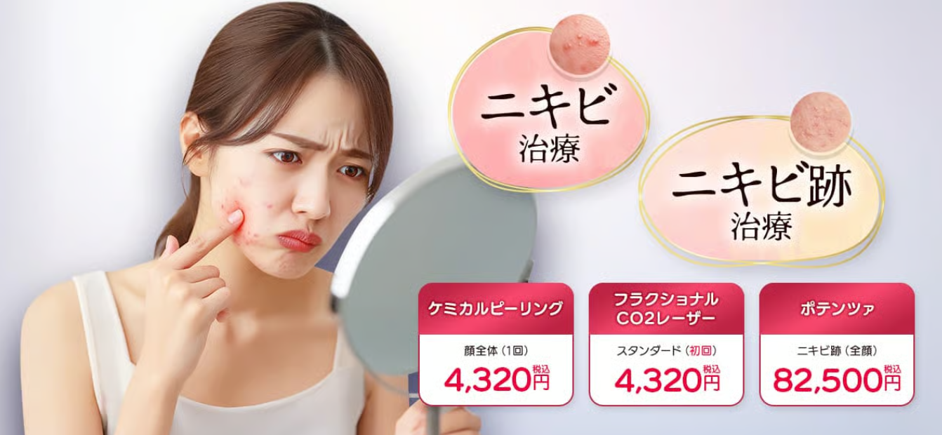 品川美容クリニックのニキビの画像