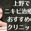 上野のニキビの画像