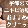 宇都宮のニキビの画像