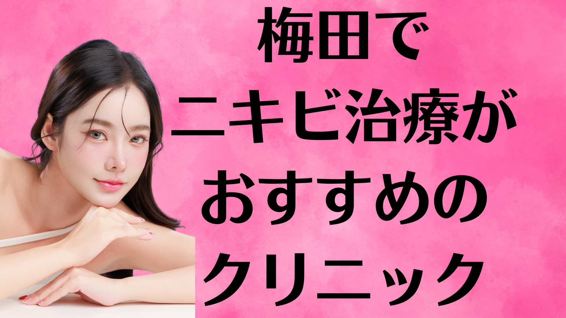 梅田のニキビの画像